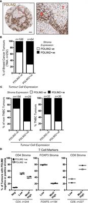 PDLIM2 is highly expressed in Breast Cancer tumour-associated macrophages and is required for M2 macrophage polarization